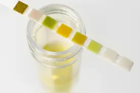 肾炎病人警惕！小便若有3表现，或是肾炎已经恶化了，要尽快治疗图片