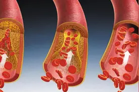 通血管，丹参和三七都可以，有什么区别，能否长期服用?一文详解图片