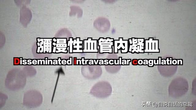 十多年老花胶多少钱 2026年十几年的花胶