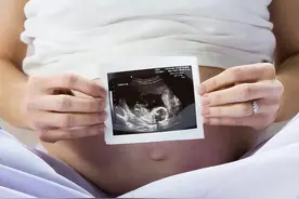 胎儿性别是受精那一刻就决定了，还是后来才决定的？真相来了图片