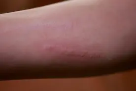 论中国人脱敏的一生！将过敏食物吃脱敏了！网友:都是祖传的图片