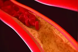 只要打通这里，就可清除“淤堵”，全身结节都散了！图片