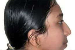 这个年龄一定要戒掉奶瓶，不然会让娃嘴巴外突，影响颜值还难矫正图片