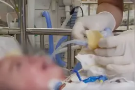 2岁宝宝被妈妈亲手拔掉氧气管，身旁的医生没有阻止，反而支持。图片