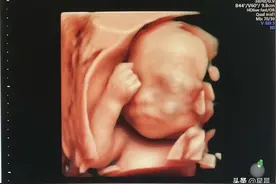 四维秒过攻略！一次过的孕妈都做对了什么？图片