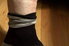 袜子勒痕竟是致命信号？腿脚6个异常，有一种死亡率极高的疾病！图片