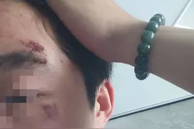 男子被别车群殴后续！现场极其惨烈，被打者拒和解，结局大快人心图片