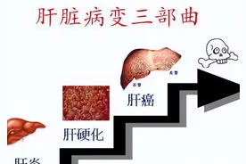 慢性乙肝患者为什么强调要做高灵敏HBVDNA定量检测？（一）图片