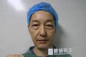 56岁大叔做了“眼袋手术”，15天恢复成这样，女儿说“很值”！图片