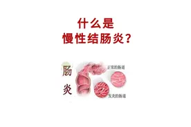慢性结肠炎、腹痛案图片