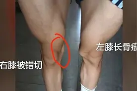 7点出发丨“17岁体育生被错切右膝案”即将开庭，母亲：拒绝和解！图片