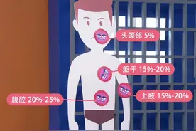 最容易被忽视的恶性肿瘤 —— 软组织肉瘤图片