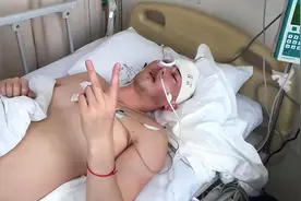 三次开颅，188阳光大男孩“容颜尽毁”，经历曝光后网友：太可惜图片