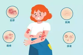 不是皮肤病，而是癌症预警？皮肤出现4种异样，警惕癌症来临图片