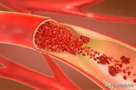 天气越冷，血管越硬，分享4个厉害的中成药，化瘀消脂、软化血管图片