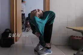 跪着上学趴着看书，身体呈Z字的“折叠男孩”，终在19岁重获新生图片