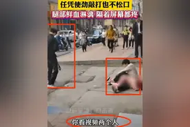 衡阳恶犬撕咬小女孩，骨头被咬穿，狗主人下跪道歉，打狗者被骂！图片