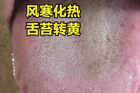 感冒三天后咳嗽，白痰转黄痰，吃什么药好？图片