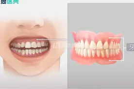 转发：为什么关于“种牙”“镶牙”的广告那么多？图片