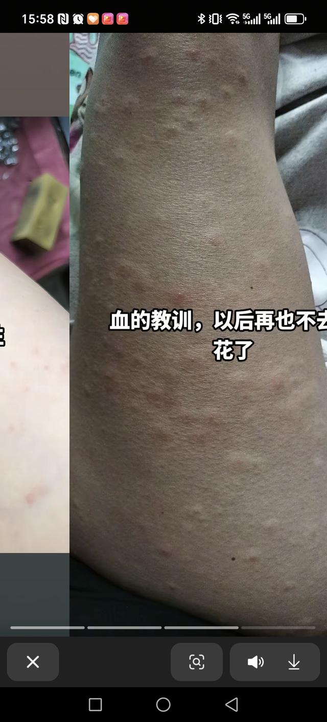 《花粉过敏者的"吃鸡"攻略：从青铜到王者的装备升级》