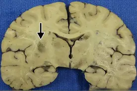 寄生虫界的“一哥”，所有温血动物都不放过，超20亿人已被感染图片