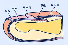 体内有疾，指甲先知？指甲出现这4种异常，可能是疾病预警图片