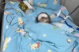 3岁男童果冻卡喉窒息进ICU，智力、四肢、语言功能均出现损伤！孩子爸爸：海姆立克法没能弄出来图片