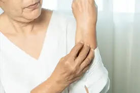 医生调查发现：易患皮肤病的人，多有这5个共性，希望你能全避开图片