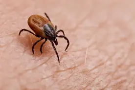 高烧到40.6℃，早期像感冒，严重可致命……这个季节高发图片