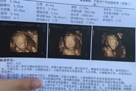 担心胎宝宝畸形，5项检查一个都不能少图片