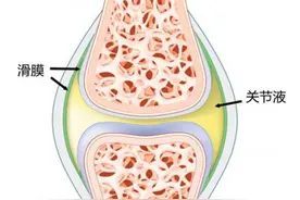 膝盖肿胀有积液，中医教你三个方法，在家就能做图片