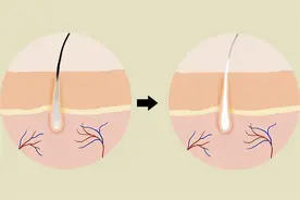 “隐私部位”毛发变白，是不是意味性功能变弱了？建议男女都了解图片