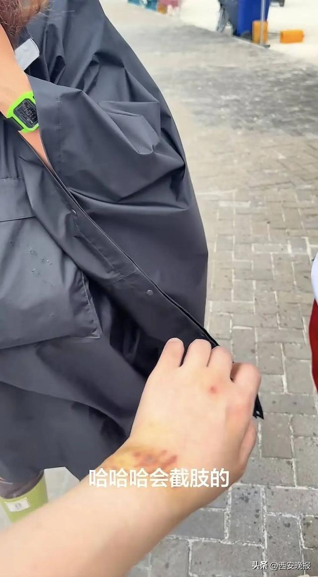 女子生理期潜水与鲨鱼群拍照时遭咬伤，被质疑“起号”炒作，当事人回应