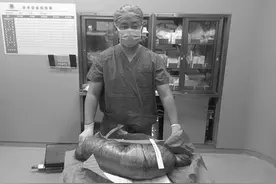 没见过这么粗的！佳木斯一女子腹中掏出“巨蟒”，竟是因为……图片