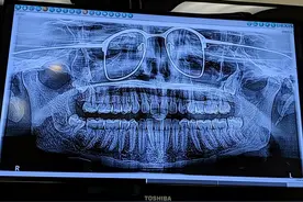 39个眼镜的搞笑瞬间，让人哭笑不得图片