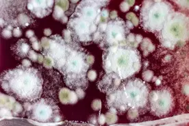 女性是怎么被霉菌性阴道炎“盯上”的？患者不妨牢记几个止痒要点图片