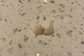 掉牙和寿命有关？55岁后，牙齿剩多少颗才正常？看看你达标了没图片