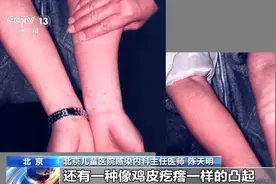 孩子高热不退全身起疹“像鸡皮疙瘩一样”，甚至出现血尿！广州疾控提醒：此病进入高发期，暂无疫苗可预防图片