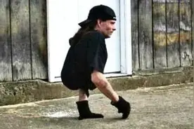 「只有半个身体的男人」：医生说他活不过24小时，但他活了42年图片