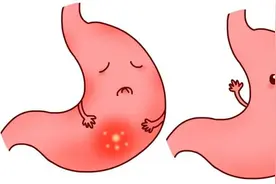 有一种难受叫“打嗝”“反胃”，一个妙方2味药，止住反胃、干呕图片
