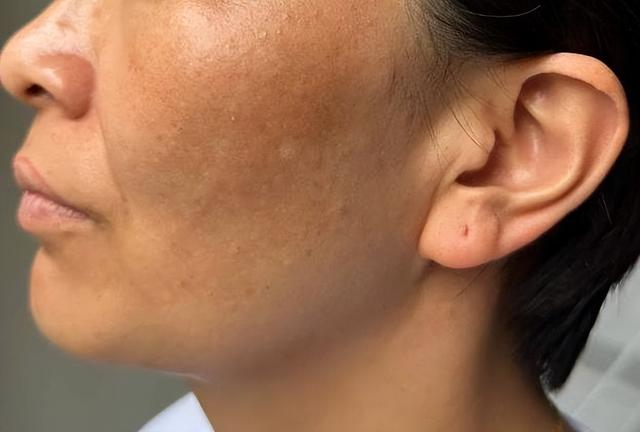 身体出现6类症状，小心肝炎！远离4个传播途径，做好预防