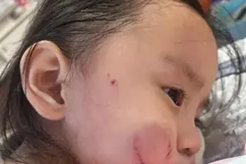 贵阳一幼儿园女童被咬伤，5分钟施暴，园方仅发被咬监控给家长！图片