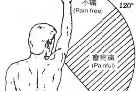 肩袖损伤不治疗会怎样图片