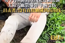 男子钓鱼距高压线太近被击倒，目击者：他拿鱼竿在高压线下面经过没注意，太阳穴处被电出血手腕也受伤了图片