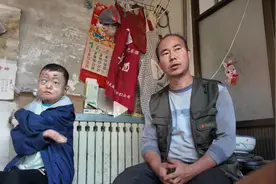 18岁蝴蝶宝贝去世，生前手指萎缩成肉球，爸爸将其埋在自家猪场旁图片