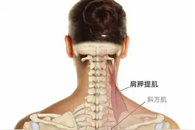 肩胛骨上角顽固性疼痛，最可能与这块肌肉有关图片