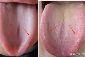 嗓子干痒，总有痰，你以为是咽炎？小心是肝出现了问题！图片