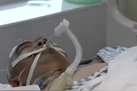 丈夫命悬一线，身为医生的妻子，却决定放弃治疗图片