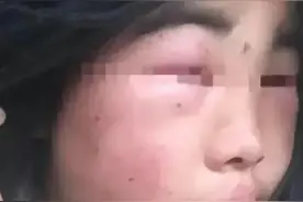 12岁女生被8名同学扇耳光3小时，致耳膜穿孔，施暴者:看谁打得响图片