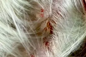 男子花5000元漂染头发致头皮二度烧伤，“事发后发型师消失了，助理也称自己失忆了”；店家：正在沟通图片